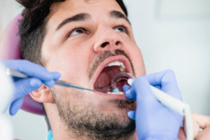 Nice patient with mouth open having doctor work in their mouth